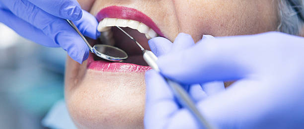 Best Emergency Root Canal Treatment in Sleepy Hollow, CA